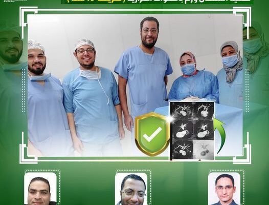 نجاح الفريق الطبي في استئصال ورم بالقناة المرارية ( لمريضة ٧٣ سنة )